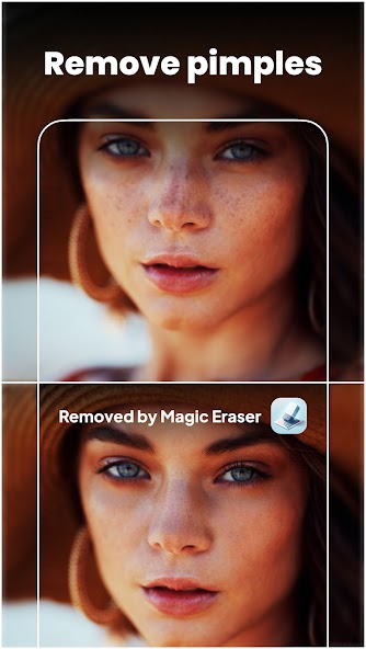 Magic Eraser – Remove Objects